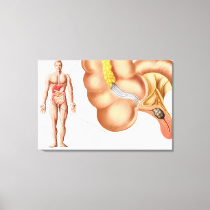Medicinska Ilustration av en bilaga Canvastryck