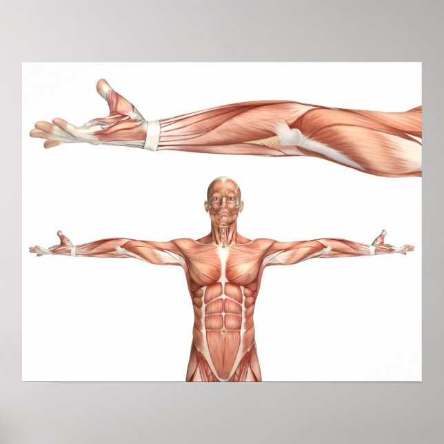 Medicinskt figur som visar armbågsupphängning poster (Framsidan)