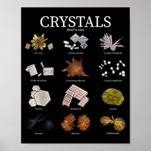 Medicinskt labb urin kristall laboratorieteknik ve poster