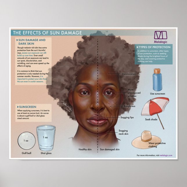 Melalogic Effekterna av Sol skada Medicinskt Poste Poster (Framsidan)