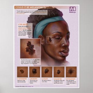 Melalogic Melanoma Medicinal Poster