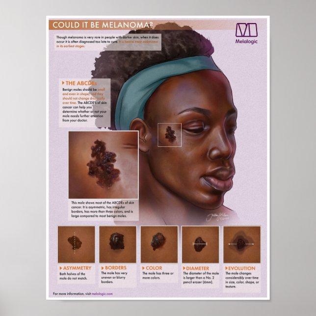 Melalogic Melanoma Medicinal Poster (Framsidan)