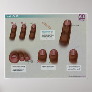 Melalogic Nagel Care Medical Poster