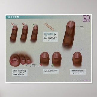 Melalogic Nagel Care Medical Poster