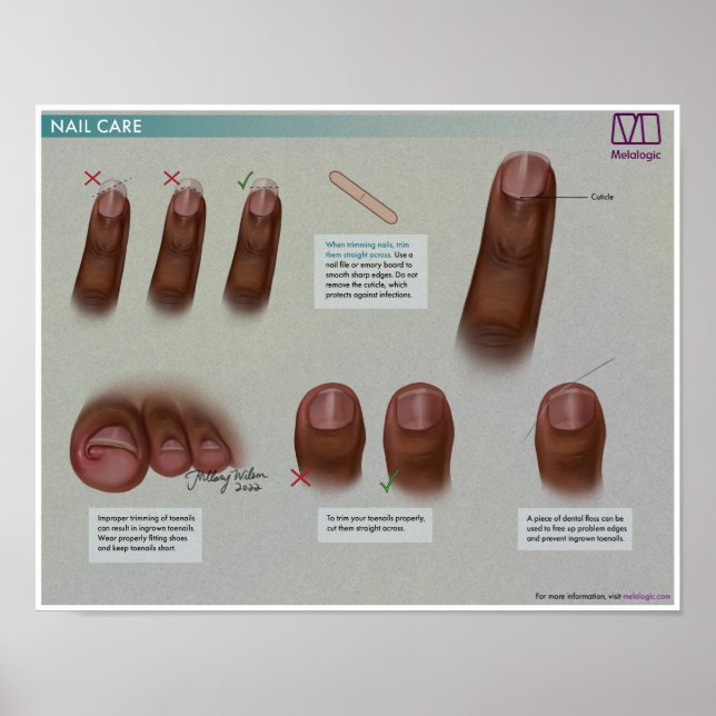 Melalogic Nagel Care Medical Poster (Framsidan)