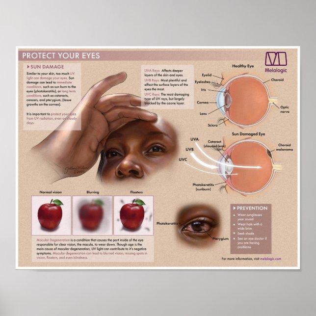 Melalogic Öga Protection Medical Poster (Framsidan)