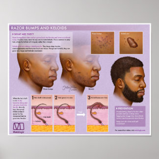 Melalogic Razor Bumps och Keloids Medical Poster