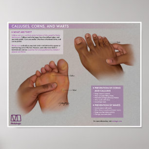 Melalogiska Poster, Maj och Warts Medical Poster