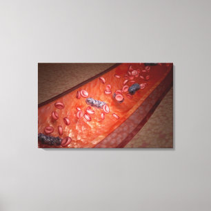Mikroskopisk rendering av en blodinfektion canvastryck