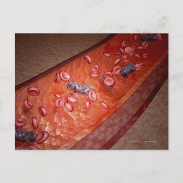 Mikroskopisk rendering av en blodinfektion vykort (Framsida)