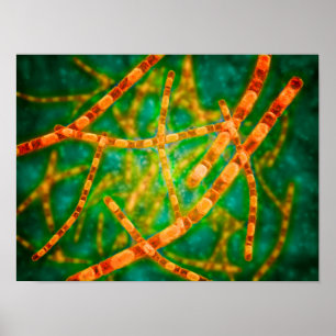 Mikroskopisk vy av mjältbrand 2 poster