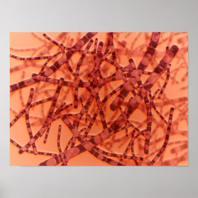 Mikroskopisk vy av mjältbrand 3 poster (Framsidan)