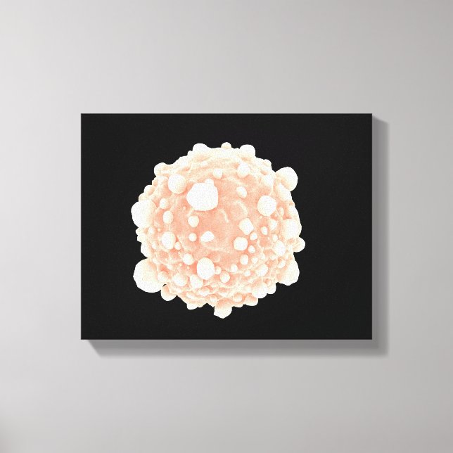 Mikroskopisk vy av pankreascancercell canvastryck (Framsida)