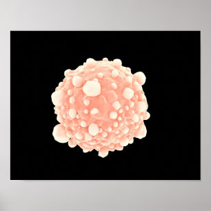 Mikroskopisk vy av pankreascancercell poster