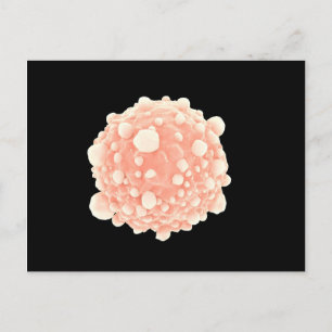 Mikroskopisk vy av pankreascancercell vykort