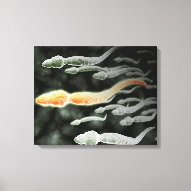 Mikroskopisk vy av Sperm Traveling Canvastryck (Framsida)