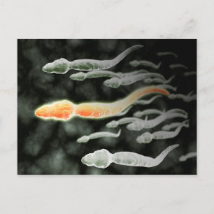 Mikroskopisk vy av Sperm Traveling Vykort
