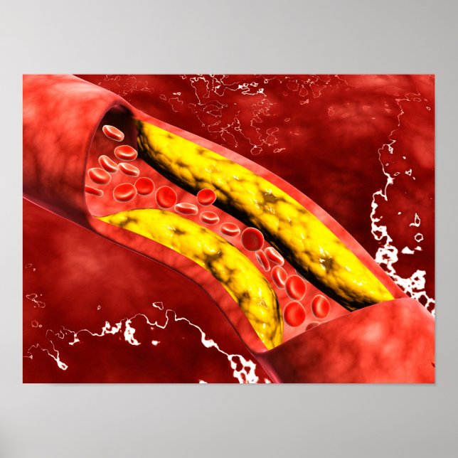 Mikroskopisk vy av Tjocken rakt inuti artären Poster (Framsidan)