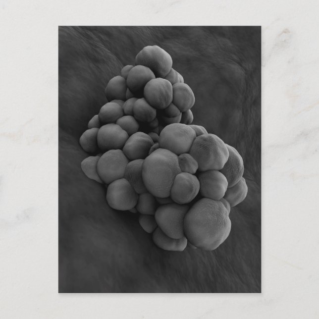 Mikroskopisk vy av tumör 1 vykort (Framsida)