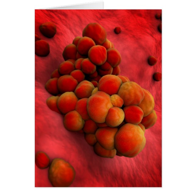 Mikroskopisk vy av tumör 2 hälsningskort (Framsidan)