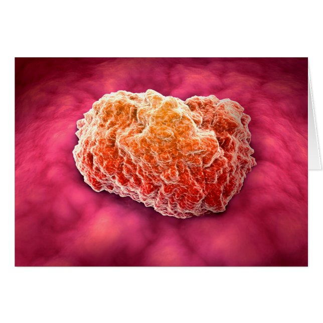 Mikroskopisk vy av tumor 3 hälsningskort (Framsidan Horizontal)