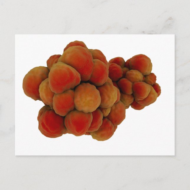 Mikroskopisk vy av tumör 4 vykort (Framsida)