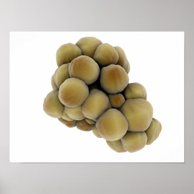 Mikroskopisk vy av tumör 5 poster (Framsidan)