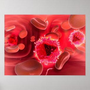 Mikroskopiskt beskåda av HIV-virusinsida lungsna Poster