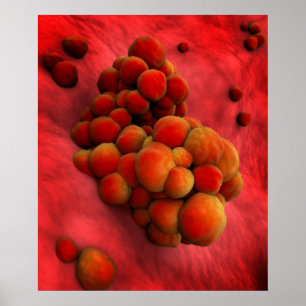 Mikroskopiskt beskåda av Tumor 2 Poster