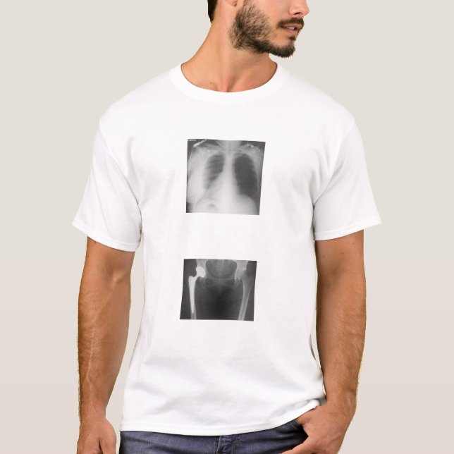 Min höft som knäckas precis från sadness. t shirt (Framsida)