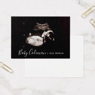 Mini Card för meddelande om gravid Sonogram Visitkort