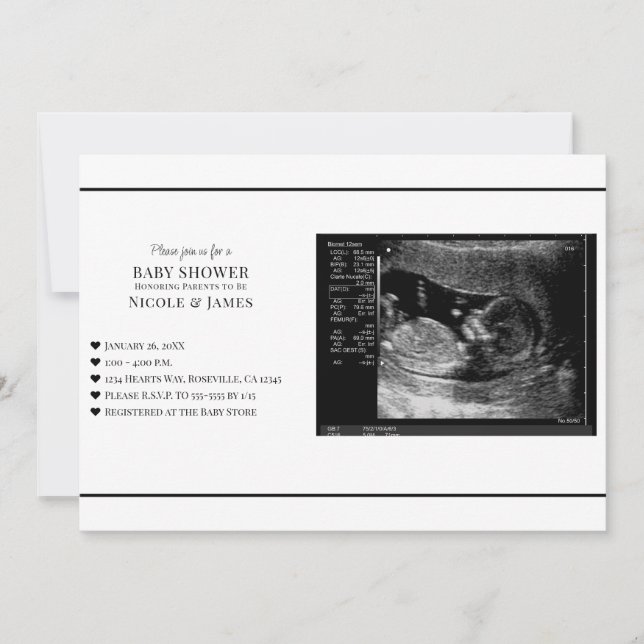 Minimal Svart & Vitt Ultraljudsfoto Baby Shower Inbjudningar (Framsida)