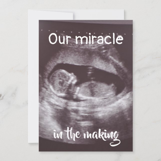 Miracle i Skapar Ultrasound 2 Photo Baby-familjen Meddelande (Framsida)