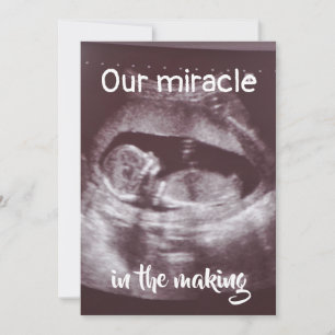 Miracle i Skapar Ultrasound 2 Photo Baby-familjen Meddelande