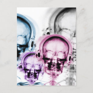 Mixed Färg X-Ray Vision Music Skeleton Skull Vykort