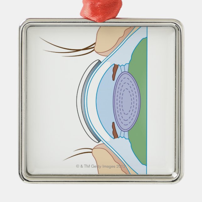 Mjuk kontakt Lens Julgransprydnad Metall (Framsidan)