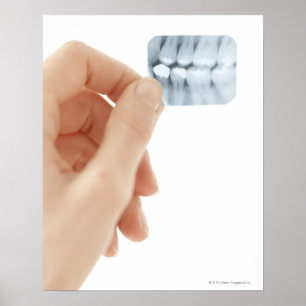 MODELL FRISLÄPPS. Dentalröntgen. Poster