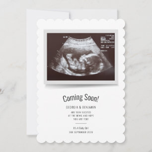Modern ultraljudsfoto kommer snart Gravid Meddelande