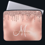 Monogram för drivrutiner i Ro Guld Glitter Laptop Fodral<br><div class="desc">Den här designen kan vara personlig i det område som tillhandahålls genom att ändra fotot och/eller text. Du kan också anpassa den genom att klicka på Anpassa den här mallen och sedan välja klicka för att anpassa ytterligare alternativ och ta bort eller ändra färg i bakgrunden, lägga till text, ändra...</div>