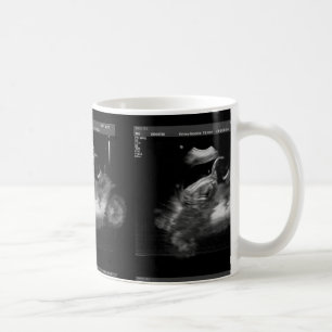 MotorcykelSonogrammugg Kaffemugg
