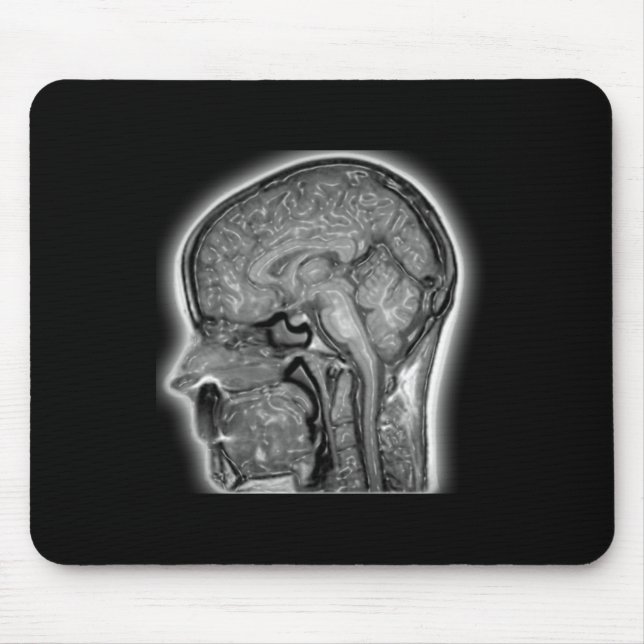 Mousepad Musmatta (Framsidan)