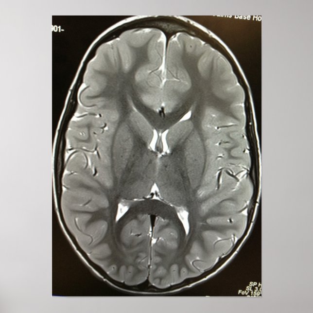 MRI Brain Poster (Framsidan)