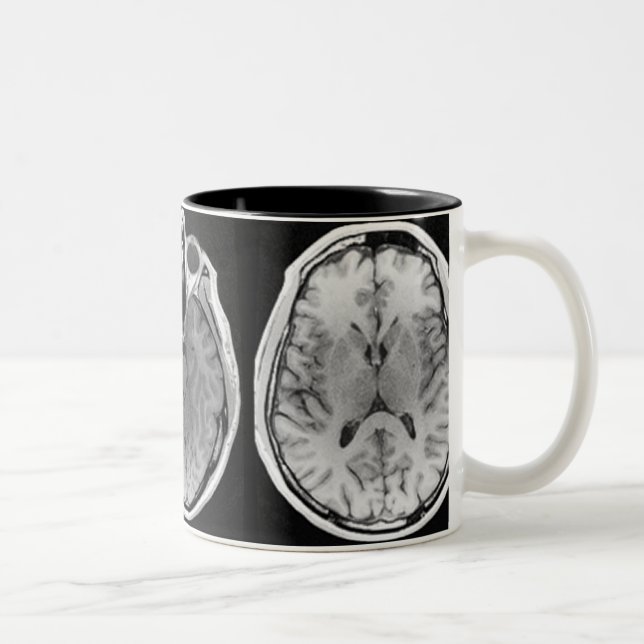 MRI-hjärnan avbildar muggen Två-Tonad Mugg (Höger)