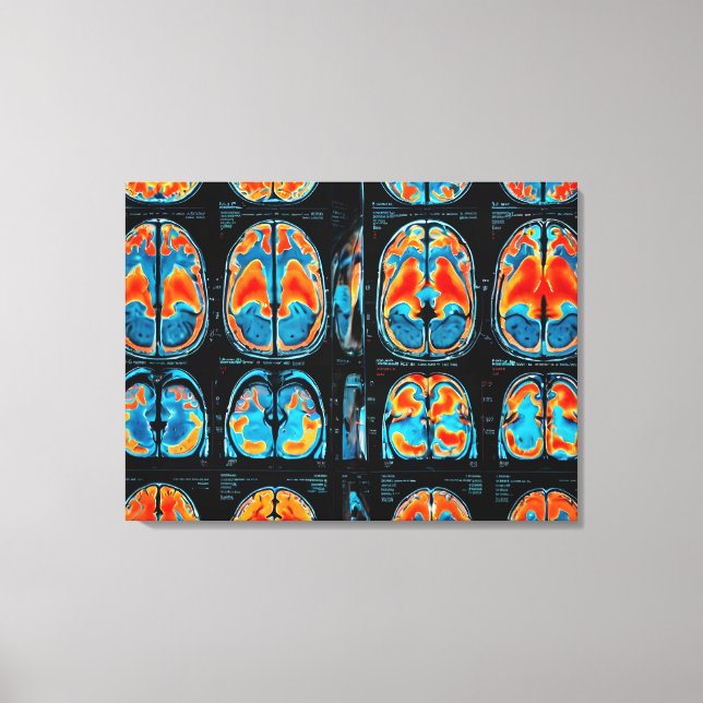 MRI hjärnskanning Canvastryck (Framsida)