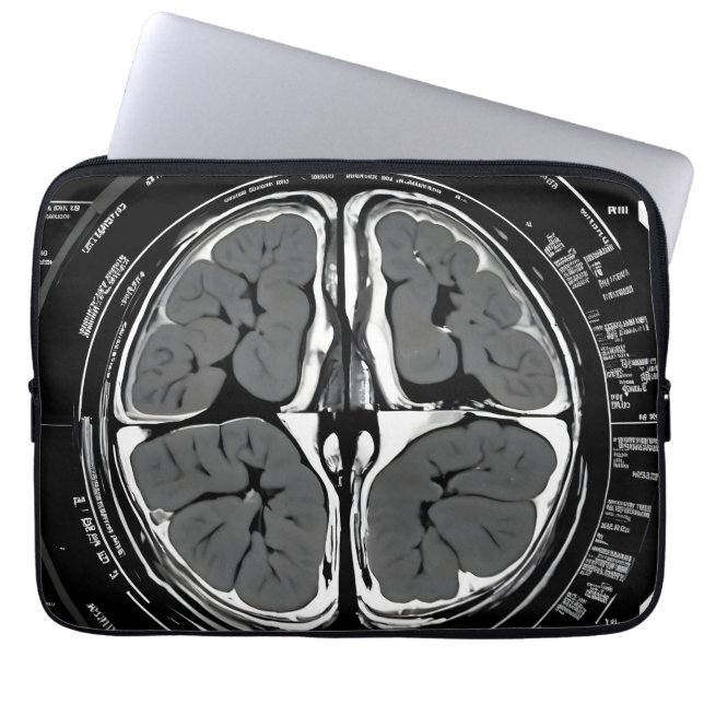 MRI hjärnskanning Laptop Fodral (Framsidan)