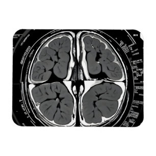 MRI hjärnskanning Magnet