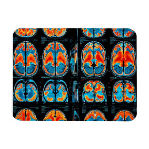 MRI hjärnskanning Magnet