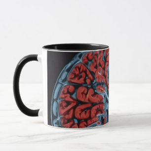MRI hjärnskanning Mugg