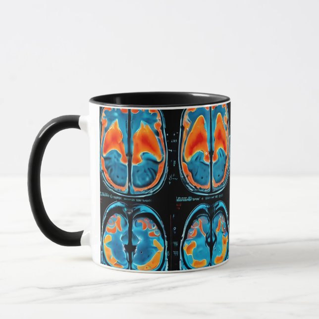 MRI hjärnskanning Mugg (Vänster)