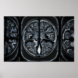 MRI hjärnskanning Poster
